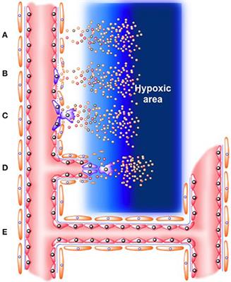 Pro-angiogenic Role of Insulin: From Physiology to Pathology